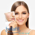 Buy Bellafill online