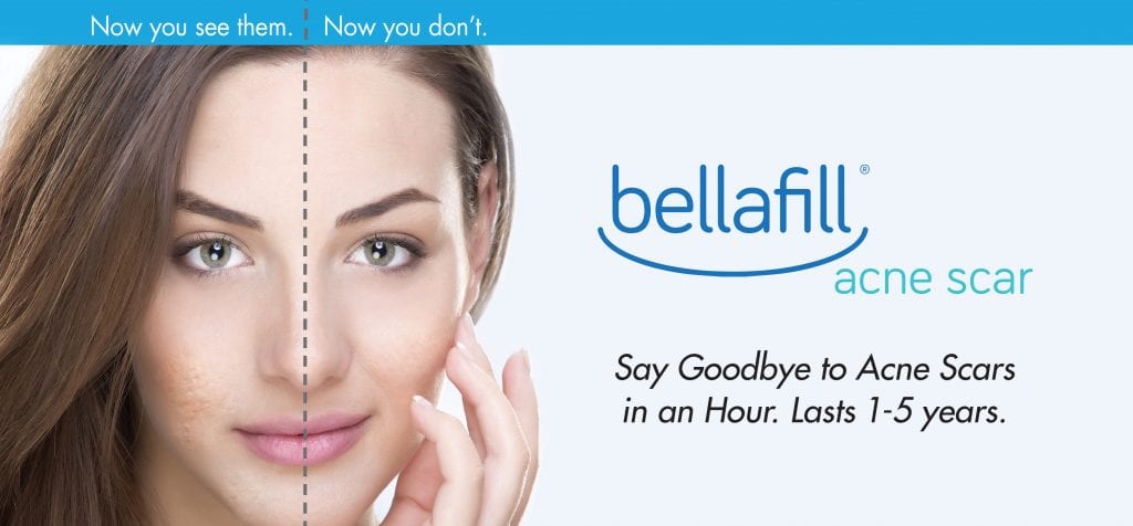 Buy Bellafill online 